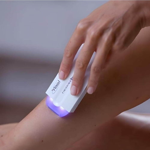 LaserRemove - Epilazione senza dolore